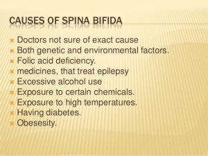 doctors notes for school facts and causes of spina bifida