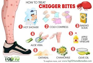 how to make a doctor note chigger bites x